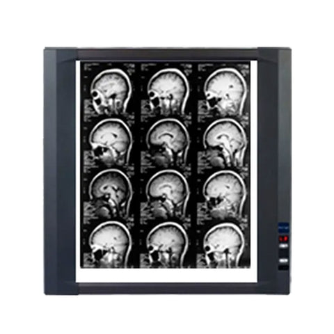 Negatoscopio LED campo 8 intensidades | MedLight | Aditamentos Médicos